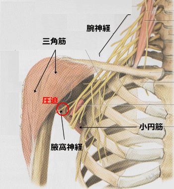 症例集 腋窩神経麻痺 太田市の患者さん かわうちはり灸整骨院 太田市 足利市