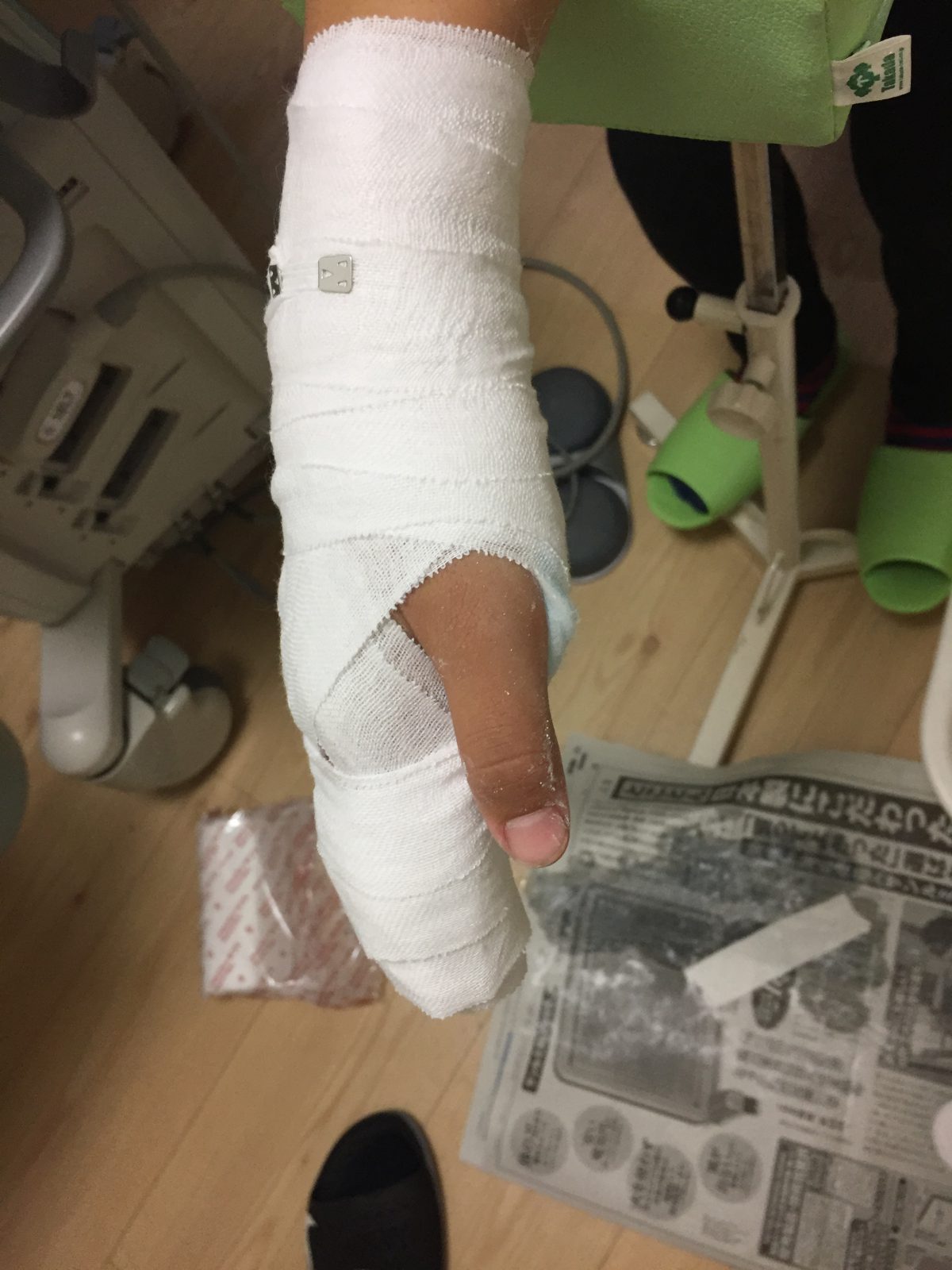 症例集：手第二指基節骨骨折 太田市 足利市 整骨院一番を目指して ｜かわうちはり灸整骨院｜太田市・足利市